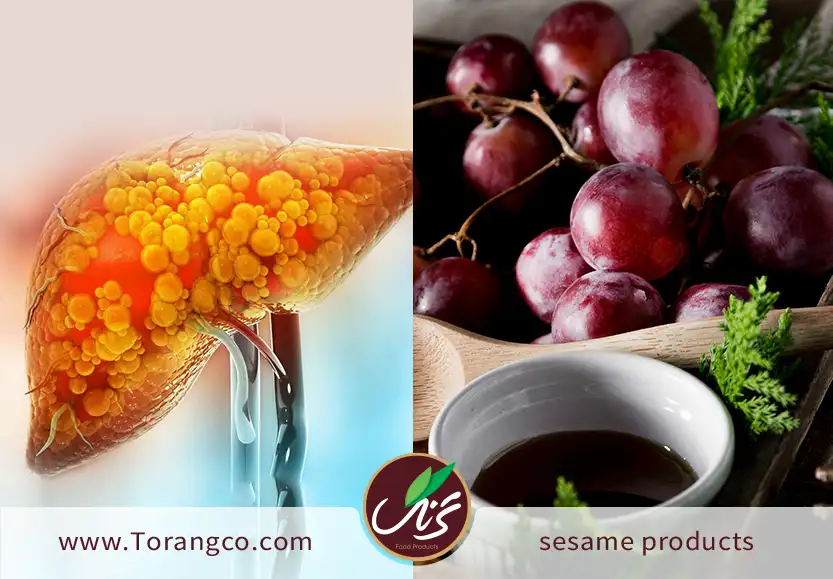 آیا شیره انگور برای مبتلایان به کبد چرب مناسب است؟