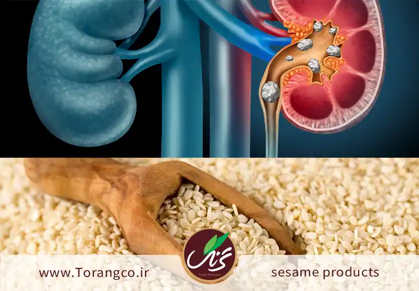 آیا مصرف زیاد کنجد باعث سنگ کلیه می‌شود؟