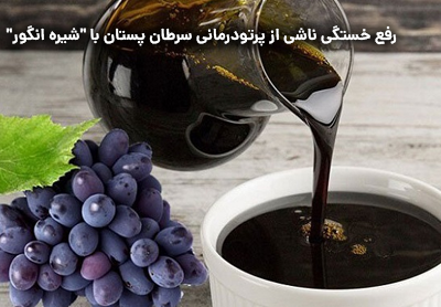 رفع خستگی ناشی از پرتودرمانی سرطان پستان با شیره انگور