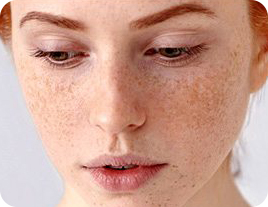 پوست آسیب دبده